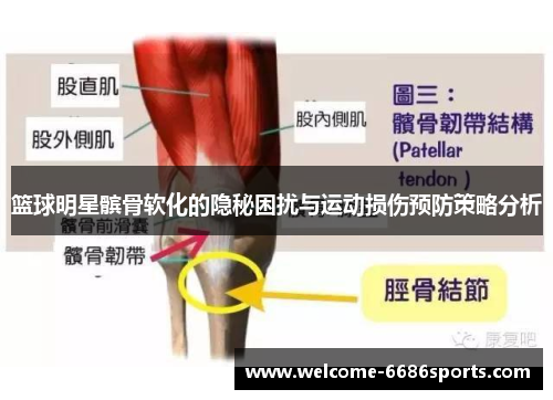 篮球明星髌骨软化的隐秘困扰与运动损伤预防策略分析